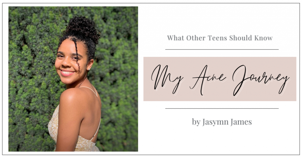 My Acne Journey by Jasmyn James