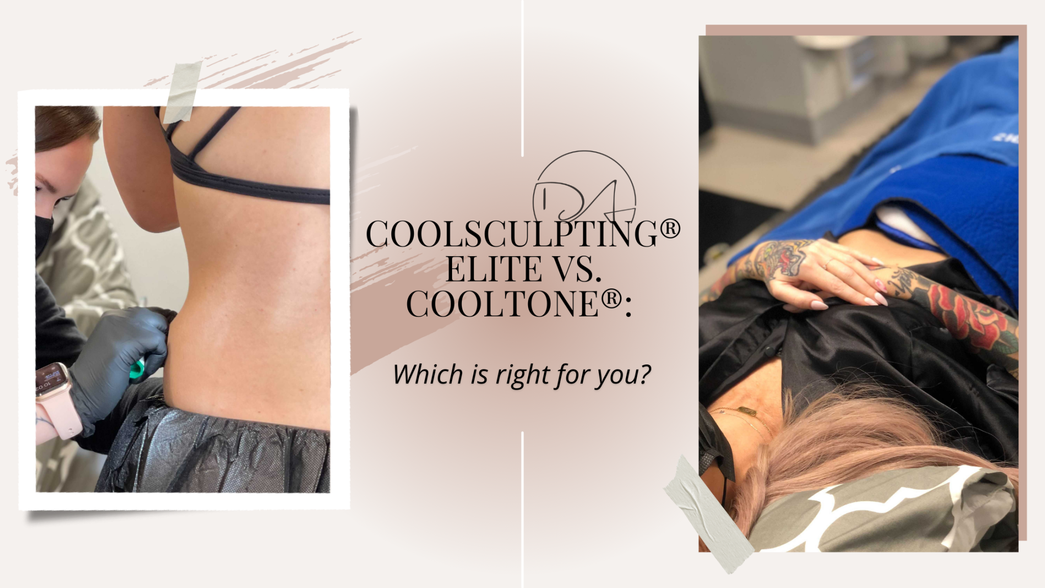 CoolSculpting® Elite vs. CoolTone® Which Is Right for You