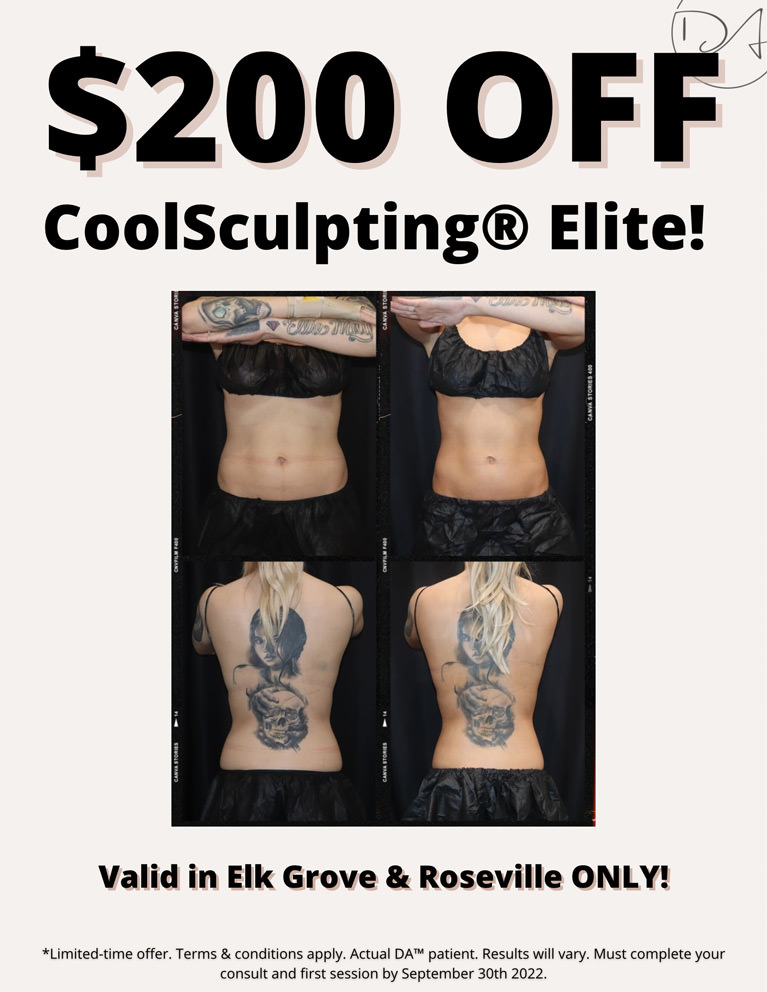 $200 Off CoolSculpting Elite!