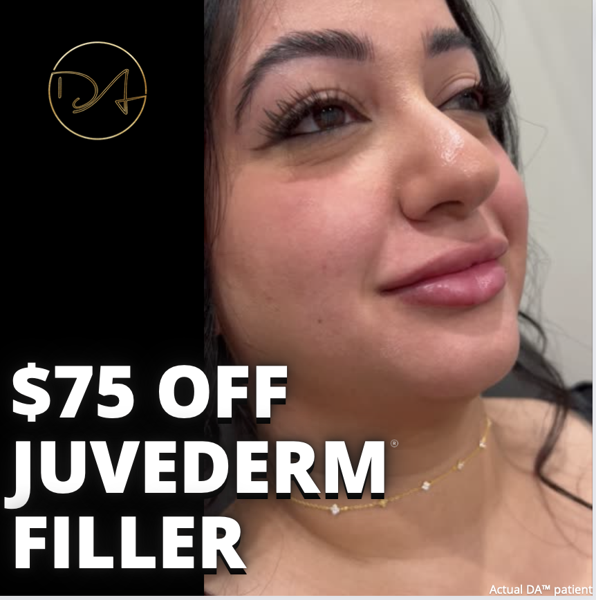 75 Off One Syringe of Juvederm® Filler Destination Aesthetics