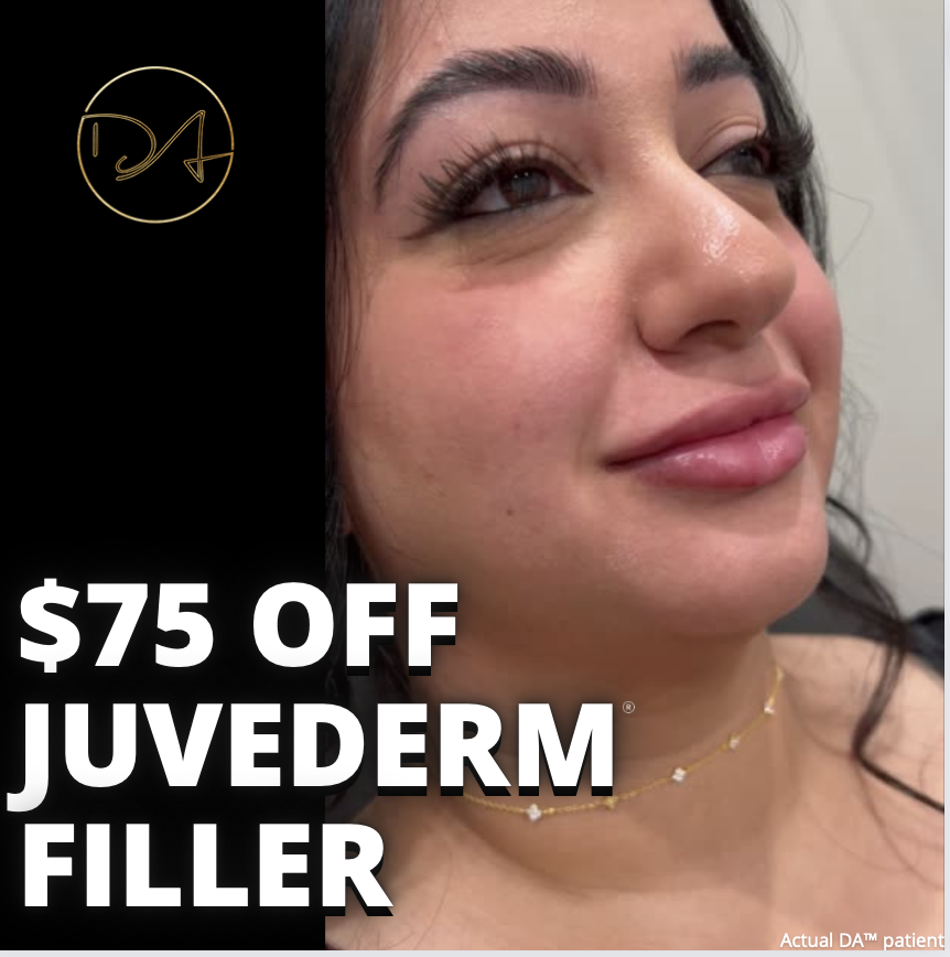 75-off-one-syringe-of-juvederm-filler-destination-aesthetics