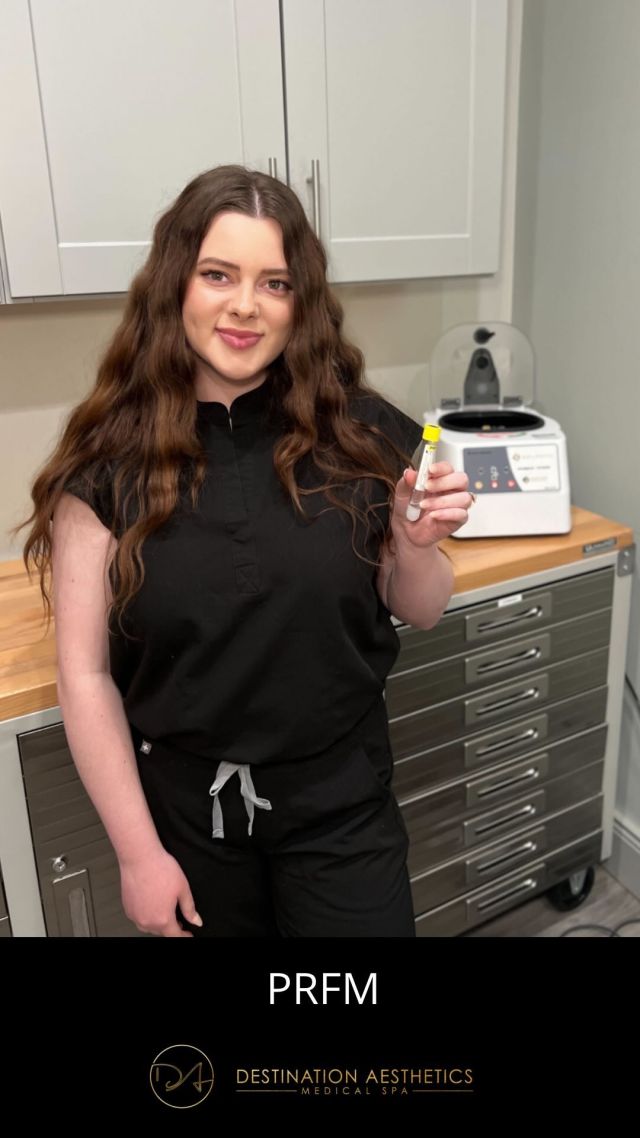 PRFM ✨ 

PRFM stands for Platelet-Rich Fibrin Matrix, which is a cosmetic treatment used to promote the growth of new tissue and improve the appearance of the skin. 🤩 As Nurse Injector Haley stated, PRFM is made from the patient’s own blood🩸, which is then processed to concentrate platelets and fibrin, both of which are important for wound healing and tissue regeneration. 

The concentrated PRFM is then injected into specific areas of the skin, where it acts as a matrix for the body’s own collagen to grow on. This can stimulate the regeneration of new tissue, improve skin texture and elasticity, and reduce the appearance of fine lines and wrinkles. 🎉

This treatment is a GREAT alternative to under-eye filler for people with thinner skin as it actually helps to regenerate that new tissue vs just fill underneath. 

For any other questions or to book a free consult for this treatment, give us a call at (916) 844-4913 or send us a text at (916) 461-8001. 

#prfm #prp #prfmundereyes #microneedling #hairrestoration